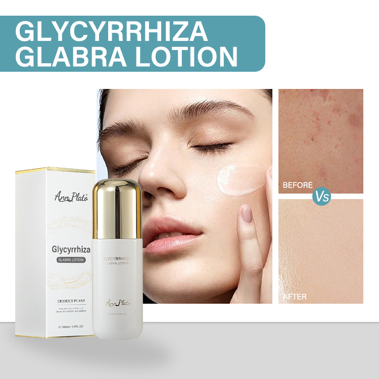 Glycyrrhiza glabra lotion — Brightening and moisturizing skin to improve dull skin